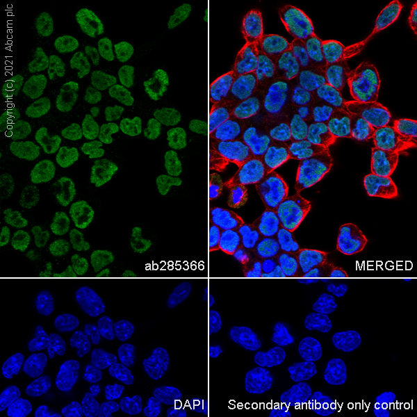 Immunocytochemistry/ Immunofluorescence - Anti-TZP antibody [EPR25998-35] (AB285366)