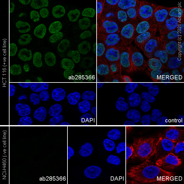 Immunocytochemistry/ Immunofluorescence - Anti-TZP antibody [EPR25998-35] (AB285366)