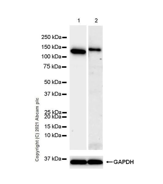 Western blot - Anti-TZP antibody [EPR25998-35] (AB285366)