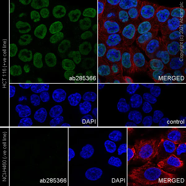 Immunocytochemistry/ Immunofluorescence - Anti-TZP antibody [EPR25998-35] - BSA and Azide free (AB285369)