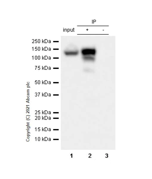 Immunoprecipitation - Anti-TZP antibody [EPR25998-35] - BSA and Azide free (AB285369)