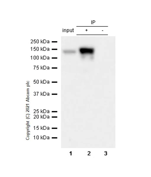 Immunoprecipitation - Anti-TZP antibody [EPR25998-35] - BSA and Azide free (AB285369)