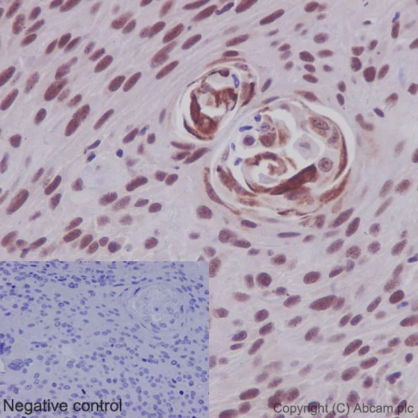 Immunohistochemistry (Formalin/PFA-fixed paraffin-embedded sections) - Anti-U1-C antibody [EPR16034] (AB192028)