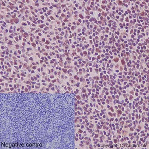 Immunohistochemistry (Formalin/PFA-fixed paraffin-embedded sections) - Anti-U1-C antibody [EPR16034] (AB192028)