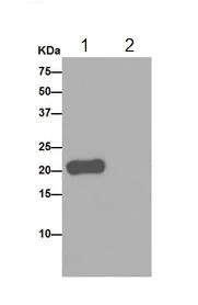 Immunoprecipitation - Anti-U1-C antibody [EPR16034] (AB192028)
