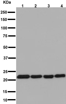 Western blot - Anti-U1-C antibody [EPR16034] (AB192028)