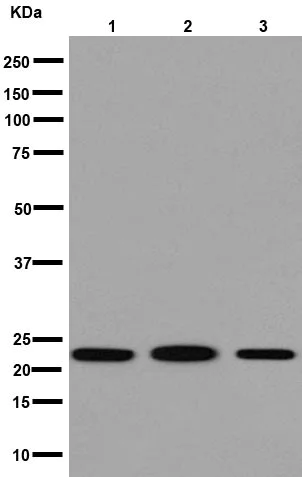 Western blot - Anti-U1-C antibody [EPR16034] (AB192028)