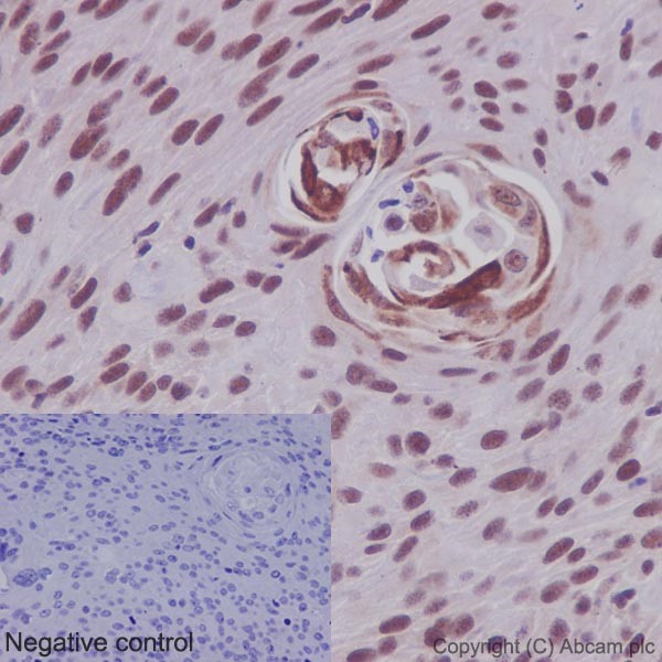 Immunohistochemistry (Formalin/PFA-fixed paraffin-embedded sections) - Anti-U1-C antibody [EPR16034] - BSA and Azide free (AB246328)