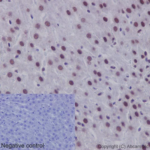 Immunohistochemistry (Formalin/PFA-fixed paraffin-embedded sections) - Anti-U1-C antibody [EPR16034] - BSA and Azide free (AB246328)
