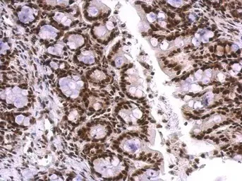 Immunohistochemistry (Formalin/PFA-fixed paraffin-embedded sections) - Anti-U1A antibody (AB155054)