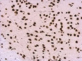Immunohistochemistry (Formalin/PFA-fixed paraffin-embedded sections) - Anti-U1A antibody (AB155054)