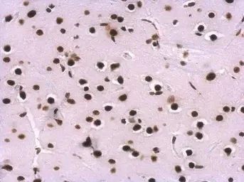 Immunohistochemistry (Formalin/PFA-fixed paraffin-embedded sections) - Anti-U1A antibody (AB155054)