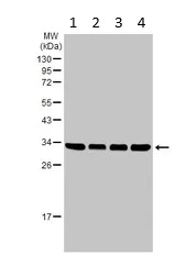 Western blot - Anti-U1A antibody (AB155054)