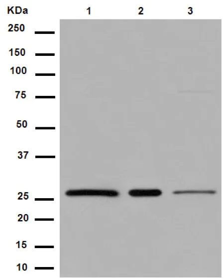 Western blot - Anti-U2AF1L4 antibody [EPR14349] - BSA and Azide free (AB250974)