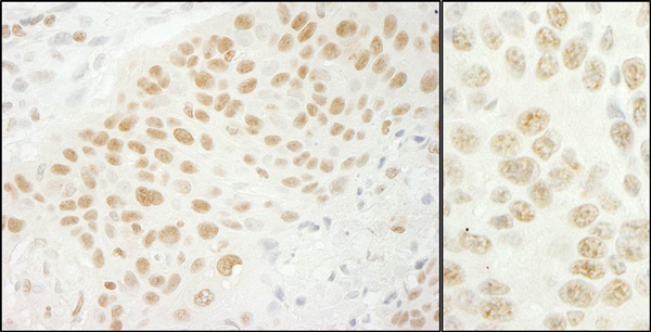 Immunohistochemistry (Formalin/PFA-fixed paraffin-embedded sections) - Anti-U2AF35/U2AF1 antibody (AB86305)