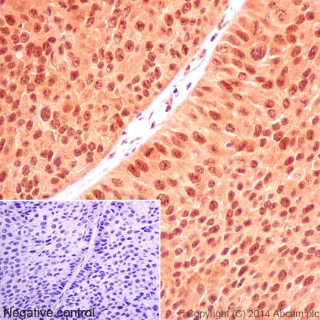 Immunohistochemistry (Formalin/PFA-fixed paraffin-embedded sections) - Anti-U2AF35/U2AF1 antibody [EPR12648(2)] - BSA and Azide free (AB251242)