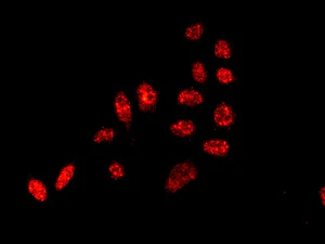 Immunocytochemistry/ Immunofluorescence - Anti-U2AF35/U2AF1 antibody [EPR12649(B)] (AB172614)