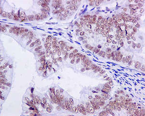Immunohistochemistry (Formalin/PFA-fixed paraffin-embedded sections) - Anti-U2AF35/U2AF1 antibody [EPR12649(B)] (AB172614)