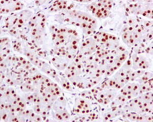 Immunohistochemistry (Formalin/PFA-fixed paraffin-embedded sections) - Anti-U2AF35/U2AF1 antibody [EPR12649(B)] (AB172614)
