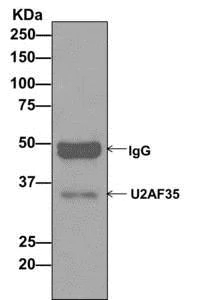 Immunoprecipitation - Anti-U2AF35/U2AF1 antibody [EPR12649(B)] - BSA and Azide free (AB249709)