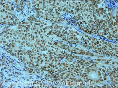 Immunohistochemistry (Formalin/PFA-fixed paraffin-embedded sections) - Anti-U2AF65 antibody (AB37530)