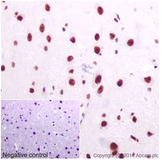 Immunohistochemistry (Formalin/PFA-fixed paraffin-embedded sections) - Anti-U2AF65 antibody [EPR17046] - C-terminal (AB197031)