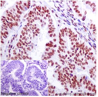 Immunohistochemistry (Formalin/PFA-fixed paraffin-embedded sections) - Anti-U2AF65 antibody [EPR17046] - C-terminal (AB197031), expandable thumbnail
