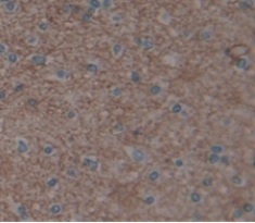 Immunohistochemistry (Formalin/PFA-fixed paraffin-embedded sections) - Anti-UACA/Nucling antibody (AB233432), expandable thumbnail