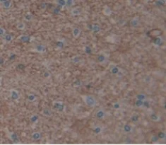 Immunohistochemistry (Formalin/PFA-fixed paraffin-embedded sections) - Anti-UACA/Nucling antibody (AB233432)