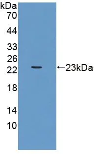 Western blot - Anti-UACA/Nucling antibody (AB233432)