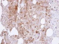 Immunohistochemistry (Formalin/PFA-fixed paraffin-embedded sections) - Anti-UAP1 antibody (AB95949)