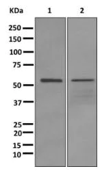 Western blot - Anti-UAP1L1 antibody [EPR11586] (AB174855)