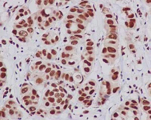 Immunohistochemistry (Formalin/PFA-fixed paraffin-embedded sections) - Anti-UAP56 antibody [EPR13144-62] - BSA and Azide free (AB250318)