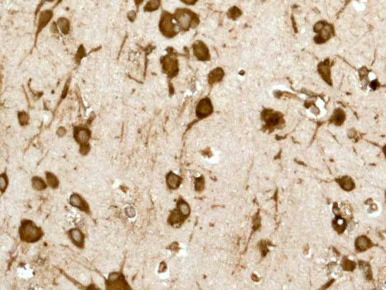 Immunohistochemistry (Formalin/PFA-fixed paraffin-embedded sections) - Anti-UBA52 antibody [EPR4546] - BSA and Azide free (AB247799)