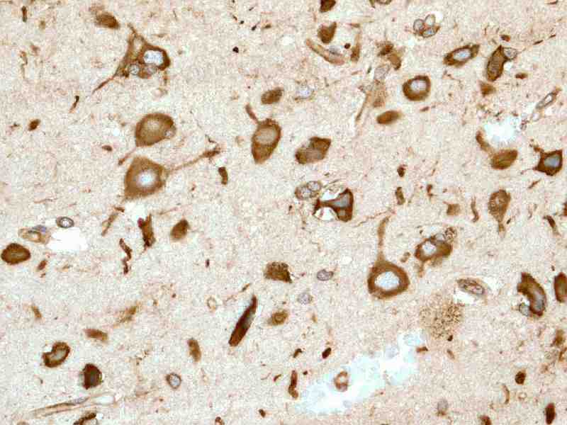 Immunohistochemistry (Formalin/PFA-fixed paraffin-embedded sections) - Anti-UBA52 antibody [EPR4547] (AB109230), expandable thumbnail