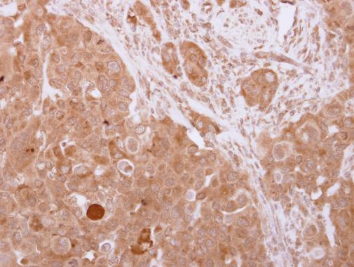 Immunohistochemistry (Formalin/PFA-fixed paraffin-embedded sections) - Anti-Uba6 antibody (AB228918), expandable thumbnail