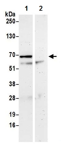 Immunoprecipitation - Anti-UBAP1 antibody (AB226338)