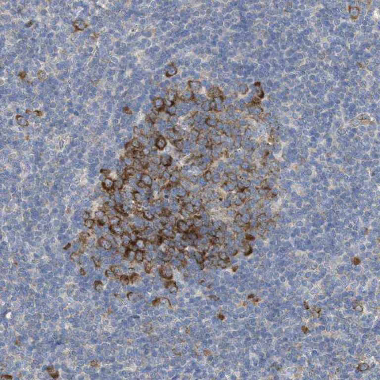 Immunohistochemistry (Formalin/PFA-fixed paraffin-embedded sections) - Anti-UBAP2 antibody (AB121693)