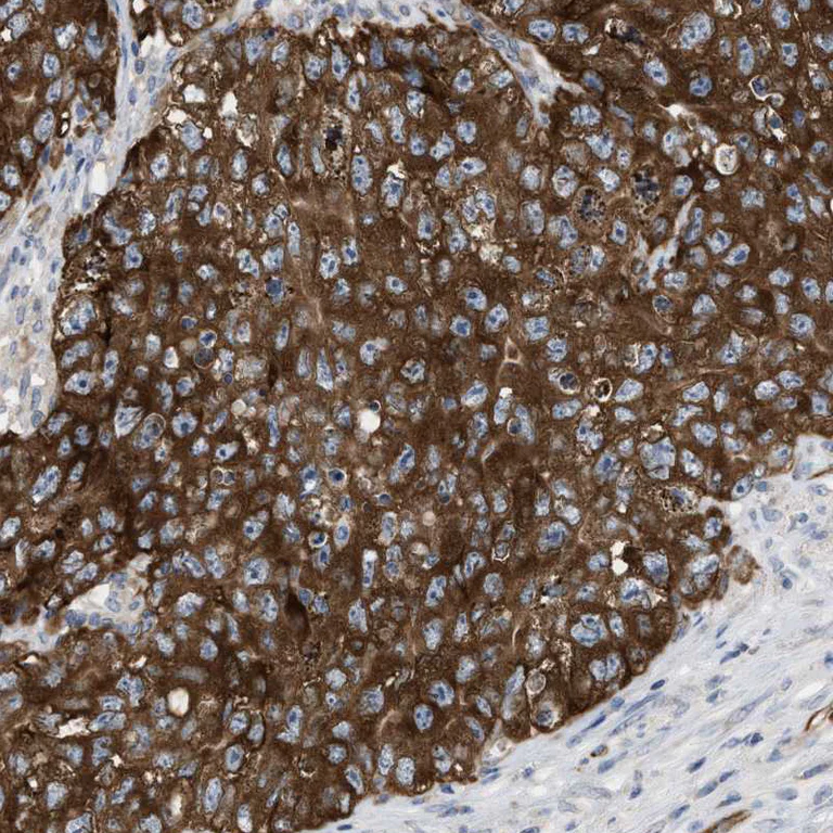 Immunohistochemistry (Formalin/PFA-fixed paraffin-embedded sections) - Anti-UBAP2 antibody (AB121693)