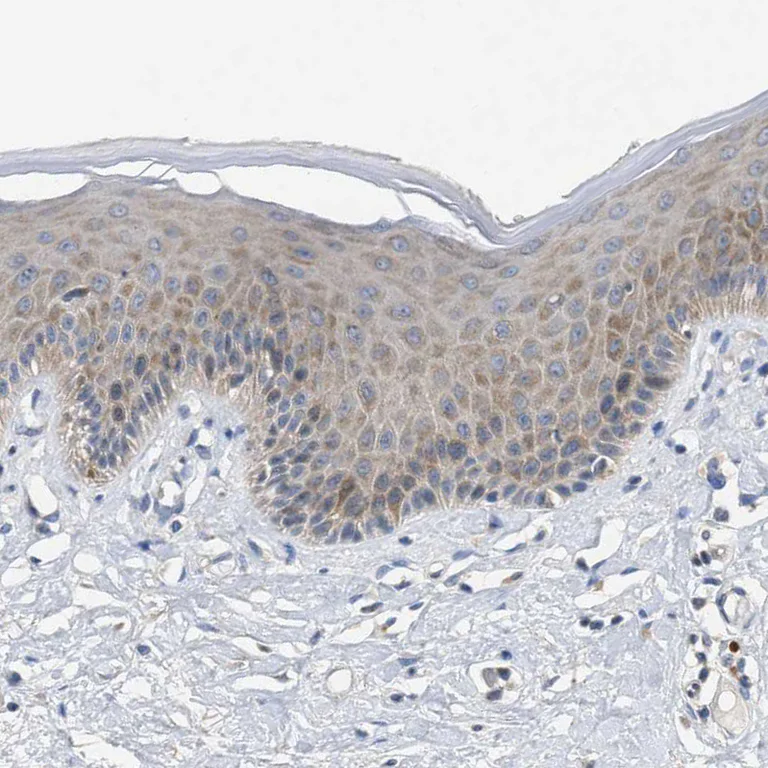 Immunohistochemistry (Formalin/PFA-fixed paraffin-embedded sections) - Anti-UBAP2 antibody (AB121693)