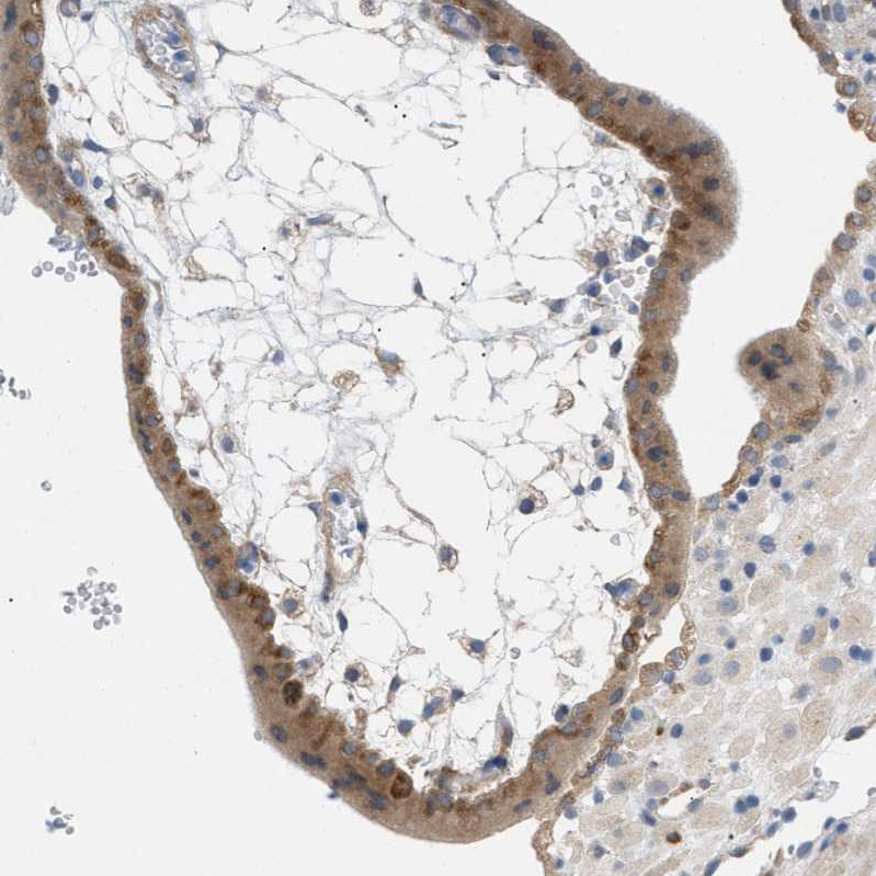 Immunohistochemistry (Formalin/PFA-fixed paraffin-embedded sections) - Anti-UBAP2 antibody (AB121693)