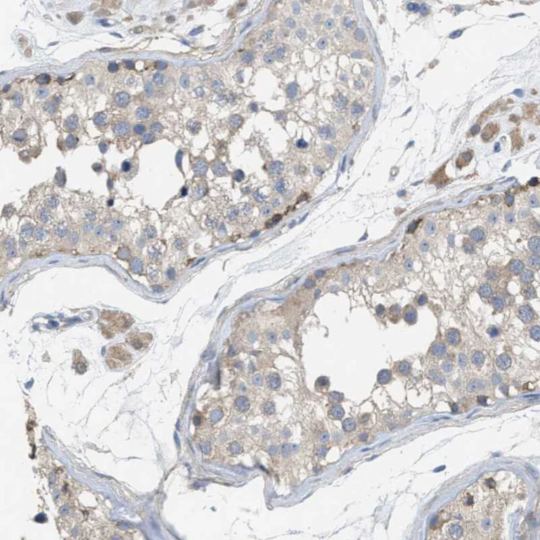 Immunohistochemistry (Formalin/PFA-fixed paraffin-embedded sections) - Anti-UBAP2 antibody (AB121693)
