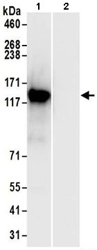 Immunoprecipitation - Anti-UBAP2 antibody (AB197083), expandable thumbnail