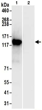 Immunoprecipitation - Anti-UBAP2 antibody (AB197083)