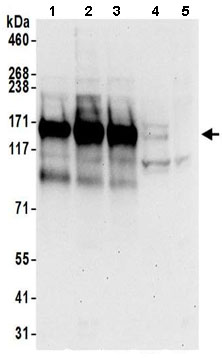 Western blot - Anti-UBAP2 antibody (AB197083), expandable thumbnail