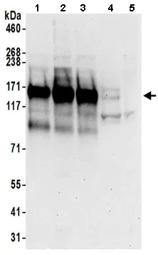 Western blot - Anti-UBAP2 antibody (AB197083)