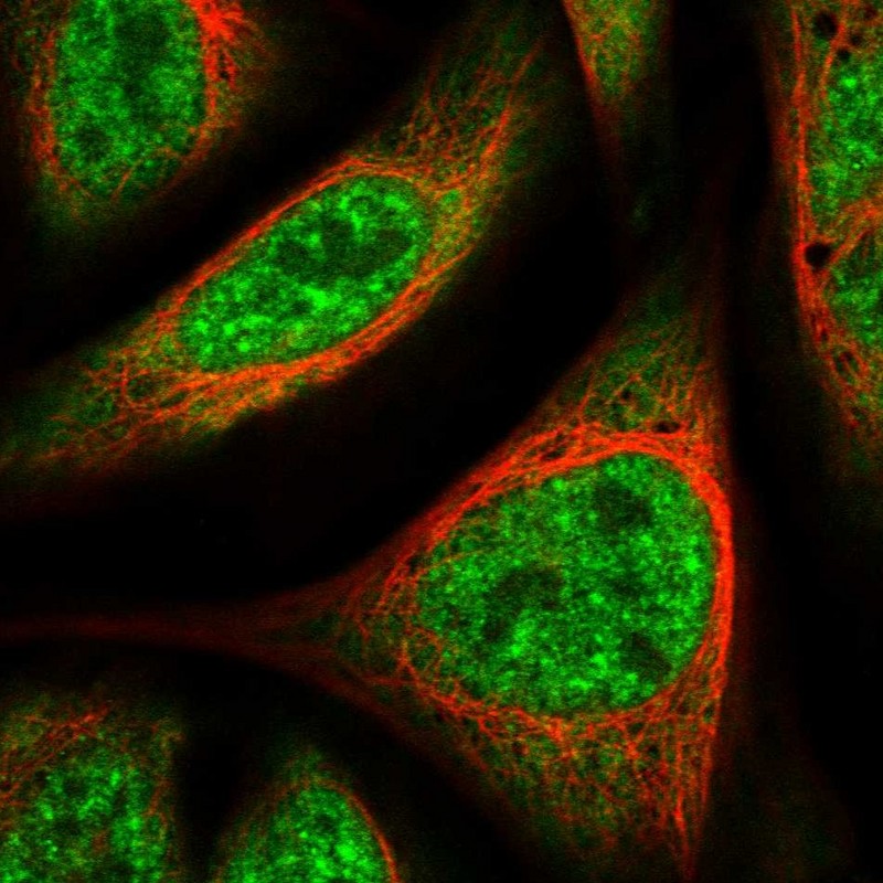 Immunocytochemistry/ Immunofluorescence - Anti-UBAP2L antibody (AB246989)