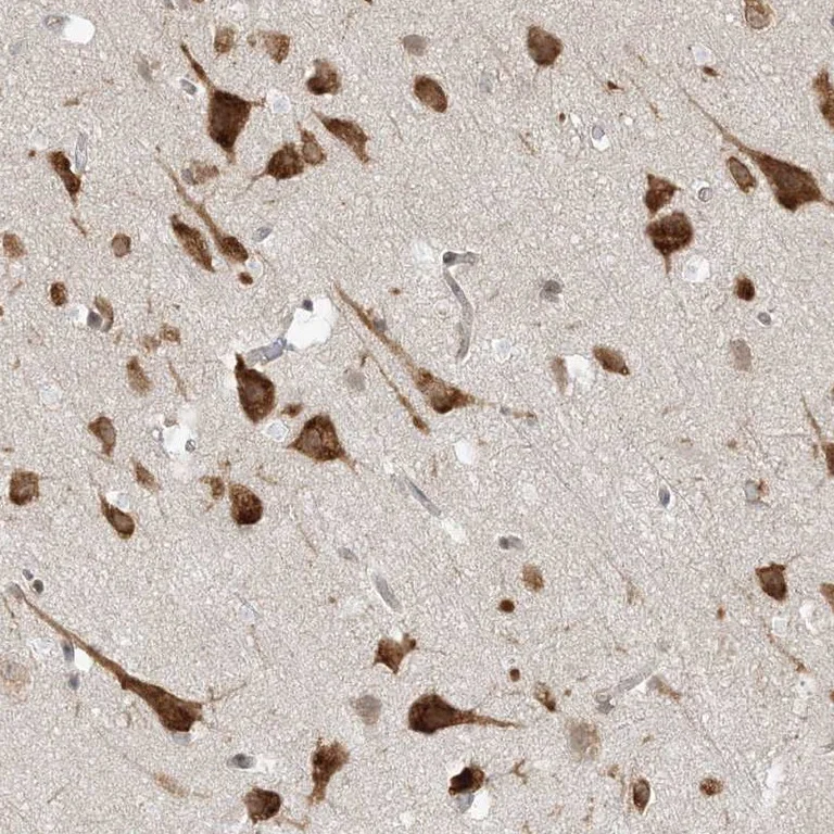 Immunohistochemistry (Formalin/PFA-fixed paraffin-embedded sections) - Anti-UBAP2L antibody (AB246989)