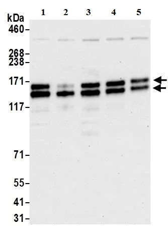 Western blot - Anti-UBAP2L antibody (AB70319)