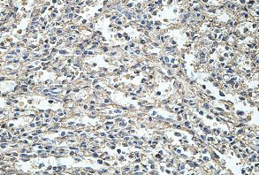 Immunohistochemistry (Formalin/PFA-fixed paraffin-embedded sections) - Anti-UBASH3A antibody (AB197168)